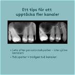 bet av en flisa av tanden